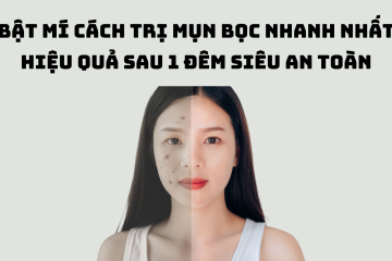 Bật mí cách trị mụn bọc nhanh nhất hiệu quả sau 1 đêm siêu an toàn