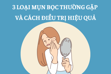 3 loại mụn bọc thường gặp và cách điều trị hiệu quả