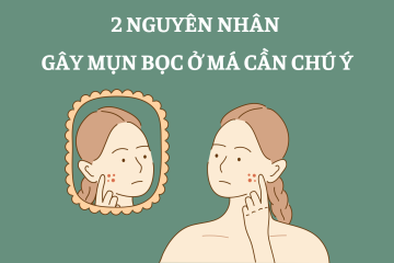 2 nguyên nhân gây mụn bọc ở má cần chú ý