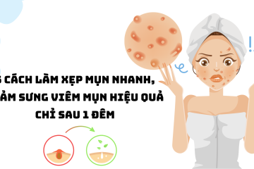 5 cách làm xẹp mụn nhanh, giảm sưng viêm mụn hiệu quả chỉ sau 1 đêm