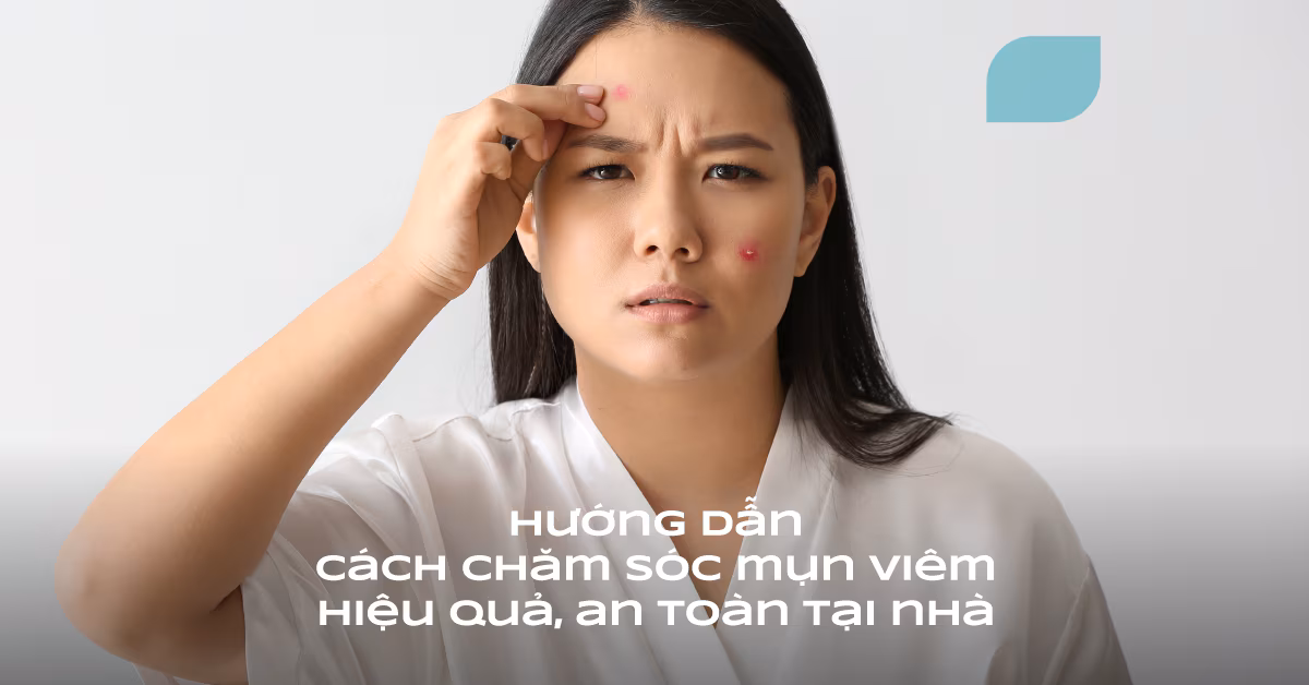 4 điều cần chú ý để không bị nhiễm khuẩn da mặt khi trị mụn viêm