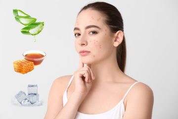 2 lý do gây mụn viêm đỏ không nhân ở tuổi dậy thì ai cũng mắc phải