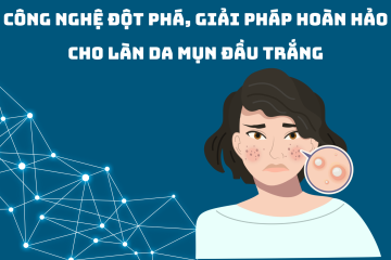 Công nghệ đột phá, giải pháp hoàn hảo cho làn da mụn đầu trắng