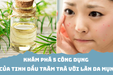 Khám phá 5 công dụng của tinh dầu tràm trà với làn da mụn