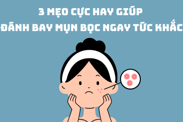 3 mẹo cực hay giúp đánh bay mụn bọc ngay tức khắc