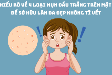 Hiểu rõ về 4 loại mụn đầu trắng trên mặt để sở hữu làn da đẹp không tì vết
