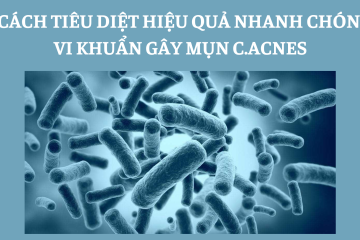 5 cách tiêu diệt hiệu quả nhanh chóng vi khuẩn gây mụn C.acnes
