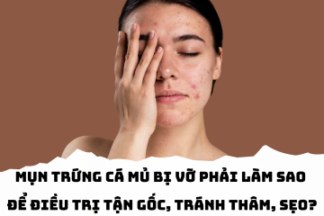 Mụn trứng cá mủ bị vỡ phải làm sao để điều trị tận gốc, tránh thâm, sẹo? Câu trả lời có ngay TẠI ĐÂY!