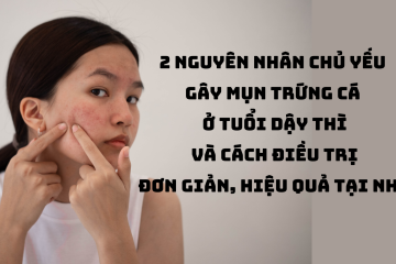 2 nguyên nhân chủ yếu gây mụn trứng cá ở tuổi dậy thì và cách điều trị đơn giản, hiệu quả tại nhà