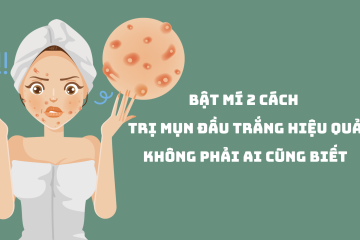 Bật mí 2 cách trị mụn đầu trắng hiệu quả không phải ai cũng biết