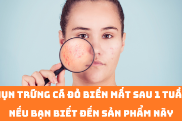 Mụn trứng cá đỏ biến mất sau 1 tuần nếu bạn biết đến sản phẩm này