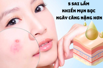 5 sai lầm khiến mụn bọc ngày càng nặng hơn