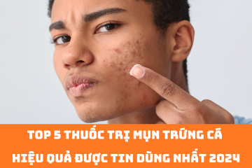 Top 5 thuốc trị mụn trứng cá hiệu quả được tin dùng nhất 2024