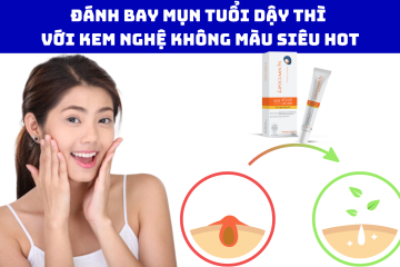 Đánh bay mụn tuổi dậy thì với kem nghệ không màu siêu hot