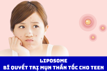 Liposome: Bí quyết trị mụn thần tốc cho teen