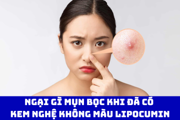 Ngại gì mụn bọc khi đã có Kem nghệ không màu LIPOCUMIN